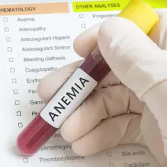 Jakie badania na anemię: Jakie testy są niezbędne do diagnozy?