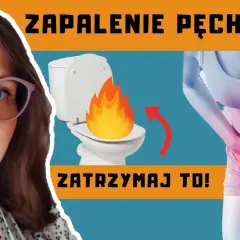 Ból pęcherza: Skuteczne metody łagodzenia bólu pęcherza