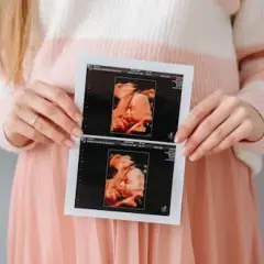 USG 4D – Przełom w Diagnostyce Obrazowej
