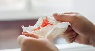 Pojawienie się flegmy z krwią: Sygnały alarmowe wymagające lekarza