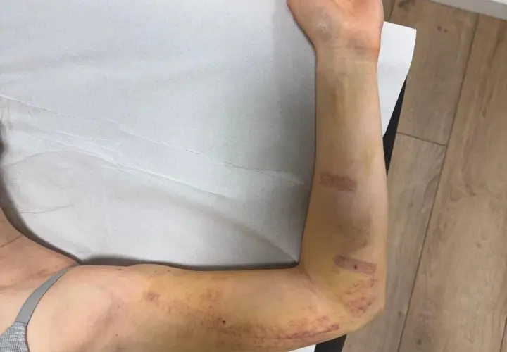 Fizjoterapia estetyczna – na czym polega?