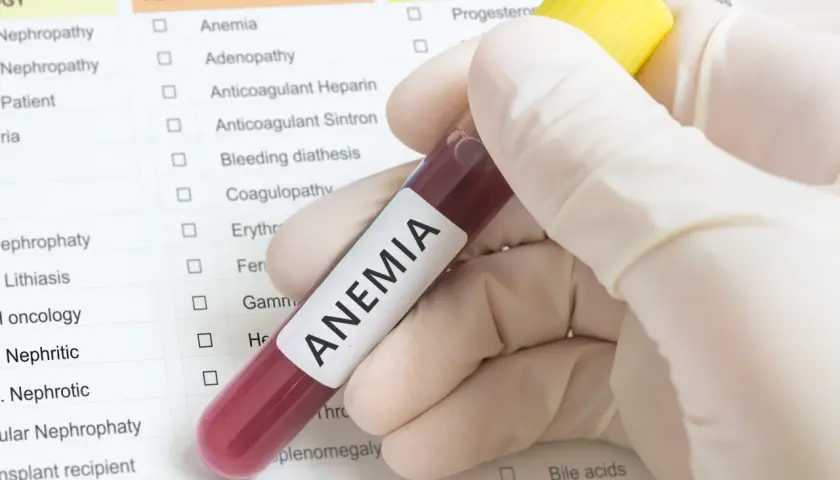Jakie badania na anemię: Jakie testy są niezbędne do diagnozy?