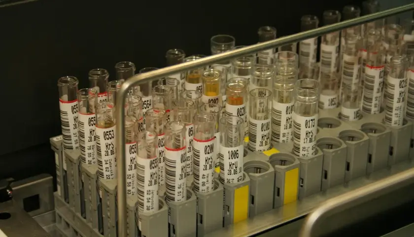 Nie każda probówka jest taka sama. Jak wybrać odpowiednią do profesjonalnego laboratorium?