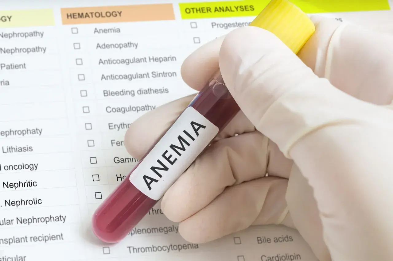 Jakie badania na anemię: Jakie testy są niezbędne do diagnozy?